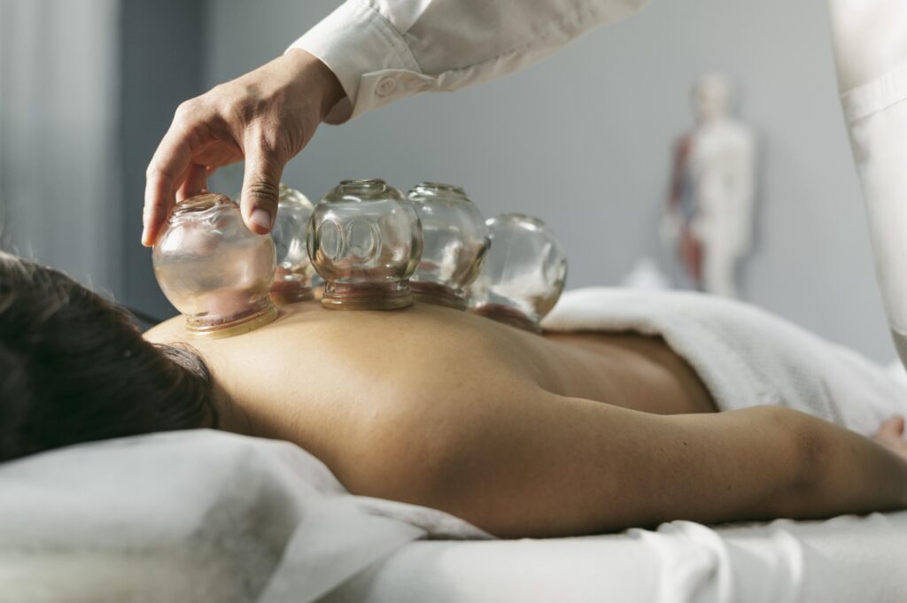 Cupping Therapy in Milton